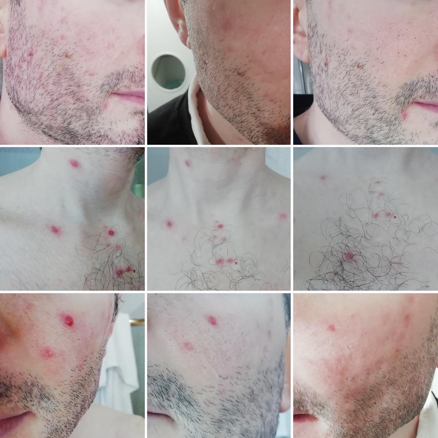 “Acqua di Maria” 2025 NEW! Puro idrolato di canapa con essenza di geranio – 50ml spray - immagine 2