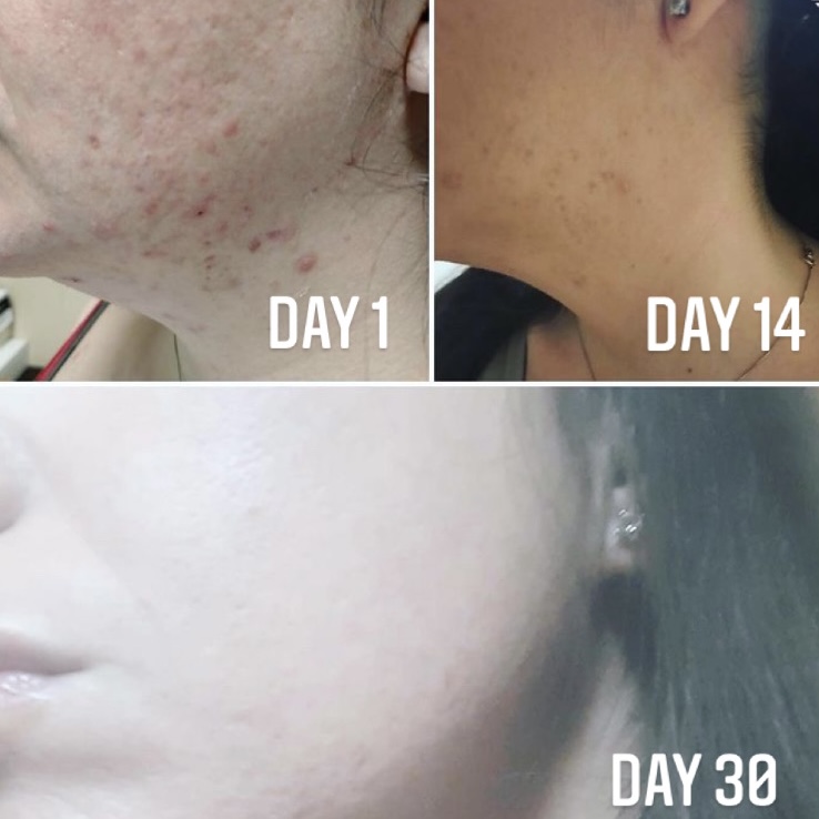 “Acqua di Maria” 2025 NEW! Puro idrolato di canapa con essenza di geranio – 50ml spray - immagine 3