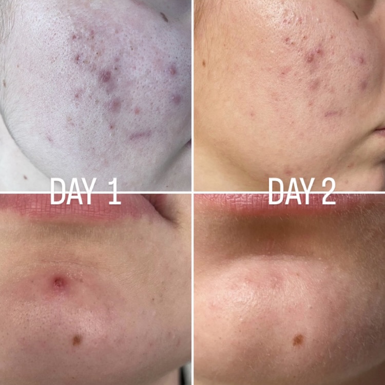 “Acqua di Maria” 2025 NEW! Puro idrolato di canapa con essenza di geranio – 50ml spray - immagine 4